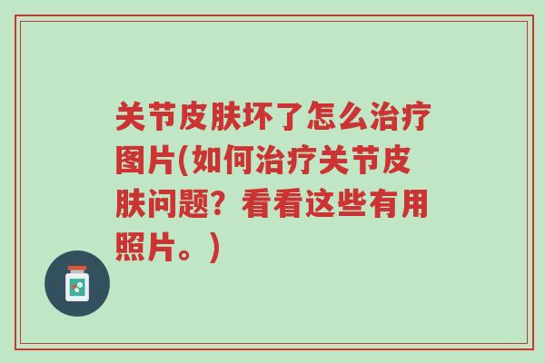 关节皮肤坏了怎么治疗图片(如何治疗关节皮肤问题？看看这些有用照片。)-第1张图片-超越