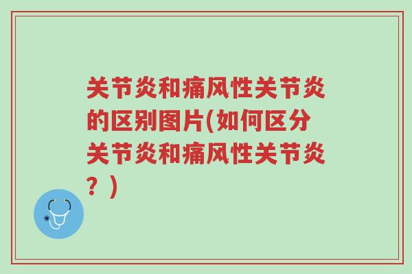 关节炎和痛风性关节炎的区别图片(如何区分关节炎和痛风性关节炎?)-第1张图片-超越 关节炎和痛风性关节炎的区别图片(如何区分关节炎和痛风性关节炎?)-第1张图片-超越