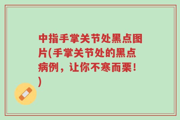 中指手掌关节处黑点图片(手掌关节处的黑点病例,让你不寒而栗!)-第1张图片-超越 中指手掌关节处黑点图片(手掌关节处的黑点病例,让你不寒而栗!)-第1张图片-超越