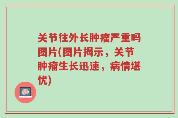 关节往外长肿瘤严重吗图片(图片揭示,关节肿瘤生长迅速,病情堪忧)-第1张图片-超越 关节往外长肿瘤严重吗图片(图片揭示,关节肿瘤生长迅速,病情堪忧)-第1张图片-超越