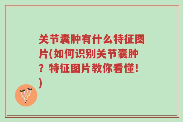 关节囊肿有什么特征图片(如何识别关节囊肿?特征图片教你看懂!)-第1张图片-超越 关节囊肿有什么特征图片(如何识别关节囊肿?特征图片教你看懂!)-第1张图片-超越