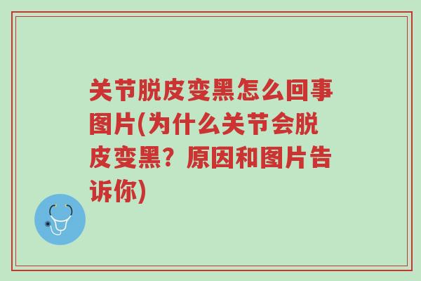 关节脱皮变黑怎么回事图片(为什么关节会脱皮变黑?原因和图片告诉你)-第1张图片-超越 关节脱皮变黑怎么回事图片(为什么关节会脱皮变黑?原因和图片告诉你)-第1张图片-超越