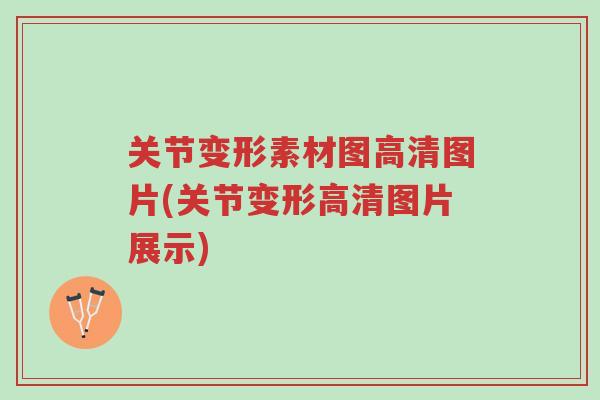关节变形素材图高清图片(关节变形高清图片展示)-第1张图片-超越 关节变形素材图高清图片(关节变形高清图片展示)-第1张图片-超越