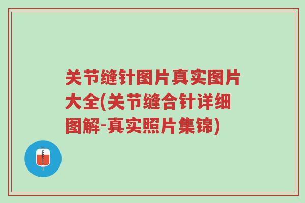 关节缝针图片真实图片大全(关节缝合针详细图解-真实照片集锦)-第1张图片-超越