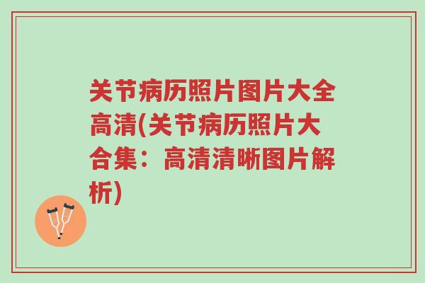 关节病历照片图片大全高清(关节病历照片大合集:高清清晰图片解析)-第1张图片-超越 关节病历照片图片大全高清(关节病历照片大合集:高清清晰图片解析)-第1张图片-超越