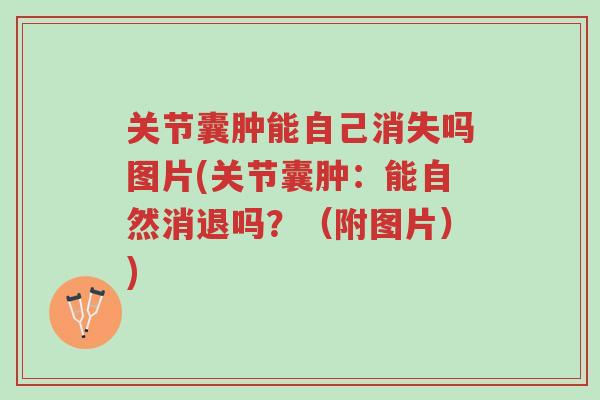 关节囊肿能自己消失吗图片(关节囊肿:能自然消退吗?(附图片))-第1张图片-超越 关节囊肿能自己消失吗图片(关节囊肿:能自然消退吗?(附图片))-第1张图片-超越