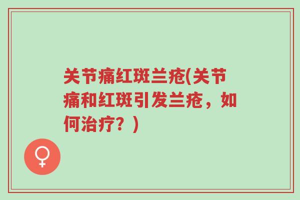 关节痛红斑兰疮(关节痛和红斑引发兰疮,如何治疗?)-第1张图片-超越 关节痛红斑兰疮(关节痛和红斑引发兰疮,如何治疗?)-第1张图片-超越