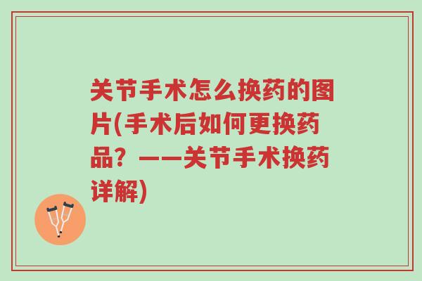 关节手术怎么换药的图片(手术后如何更换药品?——关节手术换药详解)-第1张图片-超越 关节手术怎么换药的图片(手术后如何更换药品?——关节手术换药详解)-第1张图片-超越