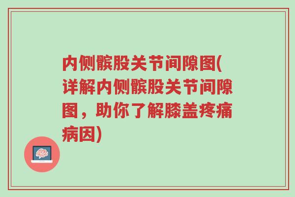 内侧髌股关节间隙图(详解内侧髌股关节间隙图,助你了解膝盖疼痛病因)-第1张图片-超越 内侧髌股关节间隙图(详解内侧髌股关节间隙图,助你了解膝盖疼痛病因)-第1张图片-超越
