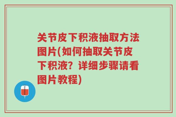 关节皮下积液抽取方法图片(如何抽取关节皮下积液?详细步骤请看图片教程)-第1张图片-超越 关节皮下积液抽取方法图片(如何抽取关节皮下积液?详细步骤请看图片教程)-第1张图片-超越
