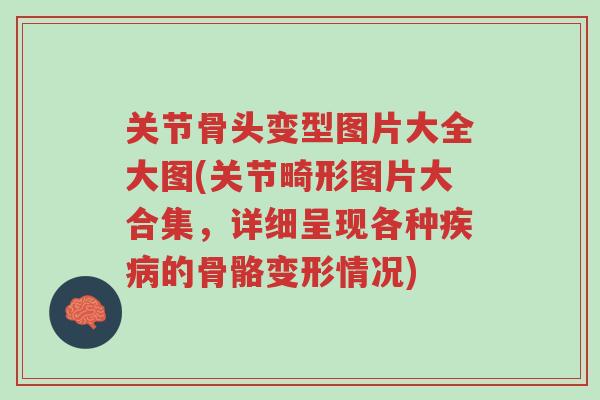 关节骨头变型图片大全大图(关节畸形图片大合集,详细呈现各种疾病的骨骼变形情况)-第1张图片-超越 关节骨头变型图片大全大图(关节畸形图片大合集,详细呈现各种疾病的骨骼变形情况)-第1张图片-超越