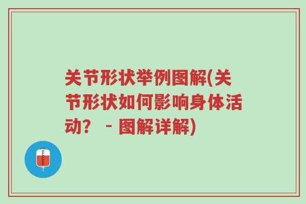 关节形状举例图解(关节形状如何影响身体活动? - 图解详解)-第1张图片-超越 关节形状举例图解(关节形状如何影响身体活动? - 图解详解)-第1张图片-超越