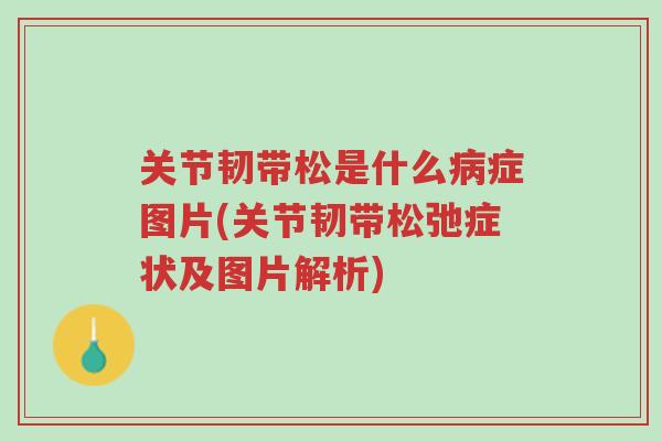 关节韧带松是什么病症图片(关节韧带松弛症状及图片解析)-第1张图片-超越 关节韧带松是什么病症图片(关节韧带松弛症状及图片解析)-第1张图片-超越