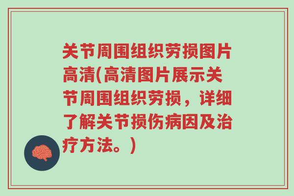 关节周围组织劳损图片高清(高清图片展示关节周围组织劳损,详细了解关节损伤病因及治疗方法。)-第1张图片-超越 关节周围组织劳损图片高清(高清图片展示关节周围组织劳损,详细了解关节损伤病因及治疗方法。)-第1张图片-超越