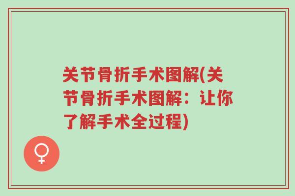 关节骨折手术图解(关节骨折手术图解：让你了解手术全过程)-第1张图片-超越