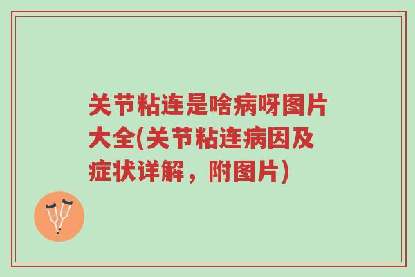 关节粘连是啥病呀图片大全(关节粘连病因及症状详解,附图片)-第1张图片-超越 关节粘连是啥病呀图片大全(关节粘连病因及症状详解,附图片)-第1张图片-超越