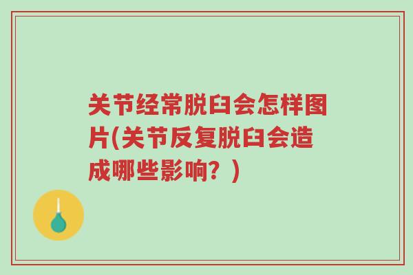关节经常脱臼会怎样图片(关节反复脱臼会造成哪些影响?)-第1张图片-超越 关节经常脱臼会怎样图片(关节反复脱臼会造成哪些影响?)-第1张图片-超越