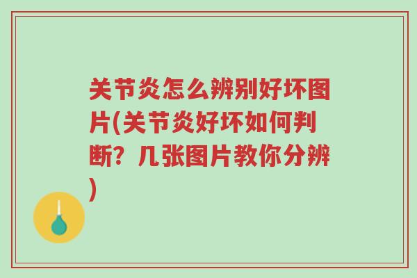 关节炎怎么辨别好坏图片(关节炎好坏如何判断?几张图片教你分辨)-第1张图片-超越 关节炎怎么辨别好坏图片(关节炎好坏如何判断?几张图片教你分辨)-第1张图片-超越