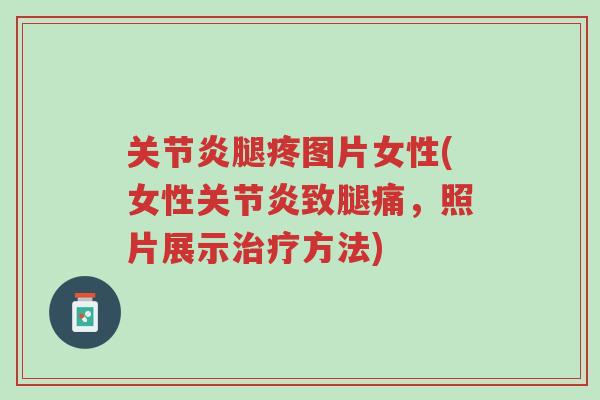 关节炎腿疼图片女性(女性关节炎致腿痛，照片展示治疗方法)-第1张图片-超越