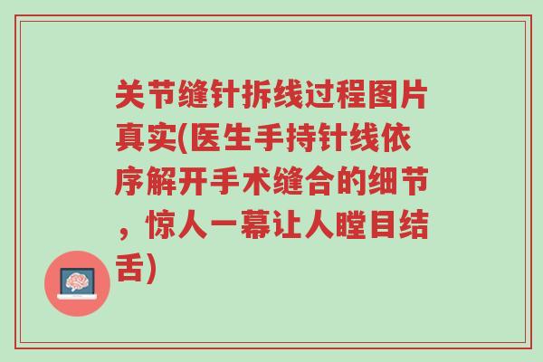 关节缝针拆线过程图片真实(医生手持针线依序解开手术缝合的细节,惊人一幕让人瞠目结舌)-第1张图片-超越 关节缝针拆线过程图片真实(医生手持针线依序解开手术缝合的细节,惊人一幕让人瞠目结舌)-第1张图片-超越