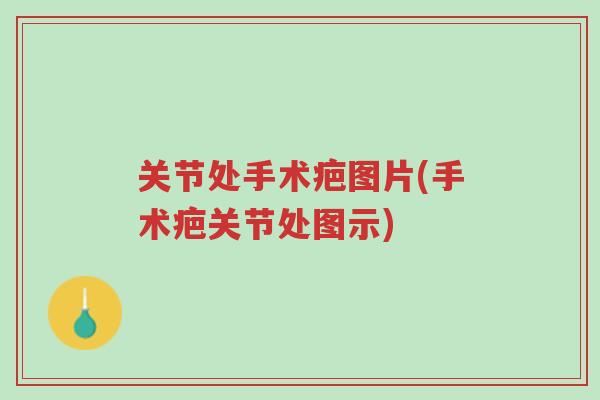 关节处手术疤图片(手术疤关节处图示)-第1张图片-超越 关节处手术疤图片(手术疤关节处图示)-第1张图片-超越