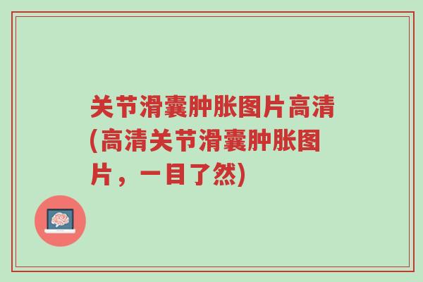 关节滑囊肿胀图片高清(高清关节滑囊肿胀图片,一目了然)-第1张图片-超越 关节滑囊肿胀图片高清(高清关节滑囊肿胀图片,一目了然)-第1张图片-超越