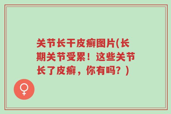关节长干皮癣图片(长期关节受累!这些关节长了皮癣,你有吗?)-第1张图片-超越 关节长干皮癣图片(长期关节受累!这些关节长了皮癣,你有吗?)-第1张图片-超越