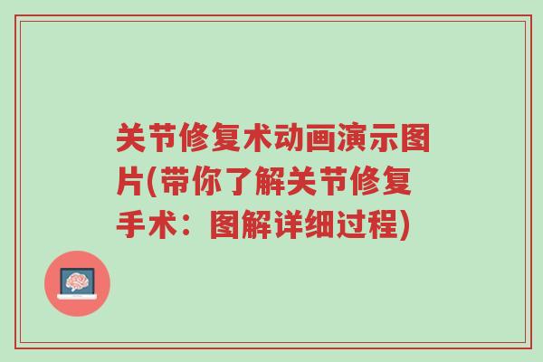 关节修复术动画演示图片(带你了解关节修复手术:图解详细过程)-第1张图片-超越 关节修复术动画演示图片(带你了解关节修复手术:图解详细过程)-第1张图片-超越