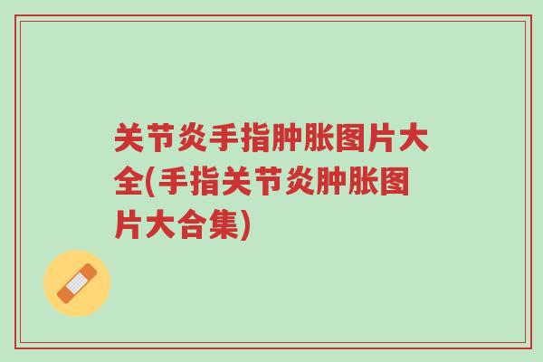 关节炎手指肿胀图片大全(手指关节炎肿胀图片大合集)-第1张图片-超越 关节炎手指肿胀图片大全(手指关节炎肿胀图片大合集)-第1张图片-超越