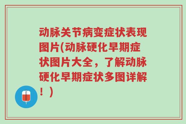 动脉关节病变症状表现图片(动脉硬化早期症状图片大全,了解动脉硬化早期症状多图详解!)-第1张图片-超越 动脉关节病变症状表现图片(动脉硬化早期症状图片大全,了解动脉硬化早期症状多图详解!)-第1张图片-超越