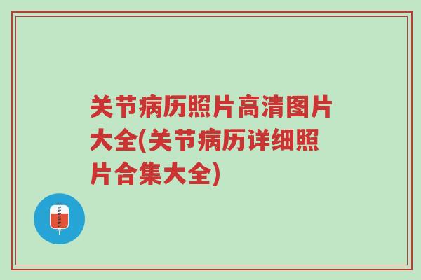 关节病历照片高清图片大全(关节病历详细照片合集大全)-第1张图片-超越 关节病历照片高清图片大全(关节病历详细照片合集大全)-第1张图片-超越