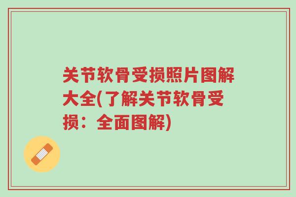 关节软骨受损照片图解大全(了解关节软骨受损:全面图解)-第1张图片-超越 关节软骨受损照片图解大全(了解关节软骨受损:全面图解)-第1张图片-超越