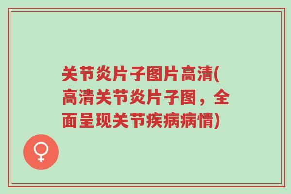 关节炎片子图片高清(高清关节炎片子图,全面呈现关节疾病病情)-第1张图片-超越 关节炎片子图片高清(高清关节炎片子图,全面呈现关节疾病病情)-第1张图片-超越