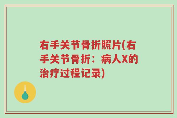 右手关节骨折照片(右手关节骨折:病人X的治疗过程记录)-第1张图片-超越 右手关节骨折照片(右手关节骨折:病人X的治疗过程记录)-第1张图片-超越