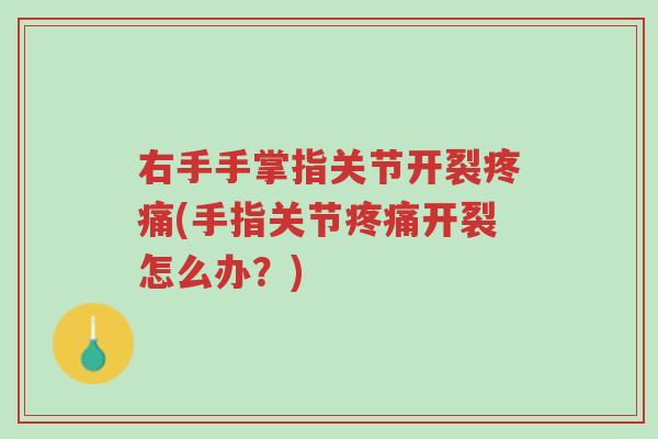 右手手掌指关节开裂疼痛(手指关节疼痛开裂怎么办?)-第1张图片-超越 右手手掌指关节开裂疼痛(手指关节疼痛开裂怎么办?)-第1张图片-超越