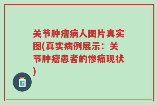 关节肿瘤病人图片真实图(真实病例展示:关节肿瘤患者的惨痛现状)-第1张图片-超越 关节肿瘤病人图片真实图(真实病例展示:关节肿瘤患者的惨痛现状)-第1张图片-超越
