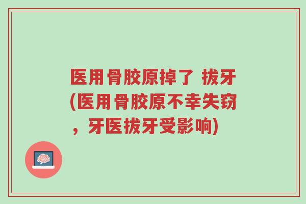 医用骨胶原掉了 拔牙(医用骨胶原不幸失窃,牙医拔牙受影响)-第1张图片-超越 医用骨胶原掉了 拔牙(医用骨胶原不幸失窃,牙医拔牙受影响)-第1张图片-超越