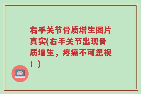 右手关节骨质增生图片真实(右手关节出现骨质增生,疼痛不可忽视!)-第1张图片-超越 右手关节骨质增生图片真实(右手关节出现骨质增生,疼痛不可忽视!)-第1张图片-超越