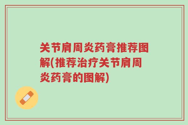 关节肩周炎药膏推荐图解(推荐治疗关节肩周炎药膏的图解)-第1张图片-超越 关节肩周炎药膏推荐图解(推荐治疗关节肩周炎药膏的图解)-第1张图片-超越