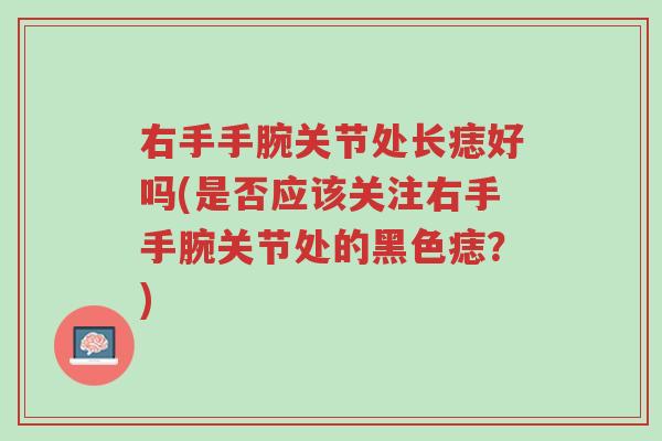 右手手腕关节处长痣好吗(是否应该关注右手手腕关节处的黑色痣?)-第1张图片-超越 右手手腕关节处长痣好吗(是否应该关注右手手腕关节处的黑色痣?)-第1张图片-超越