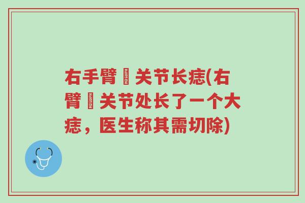 右手臂肑关节长痣(右臂肑关节处长了一个大痣,医生称其需切除)-第1张图片-超越 右手臂肑关节长痣(右臂肑关节处长了一个大痣,医生称其需切除)-第1张图片-超越
