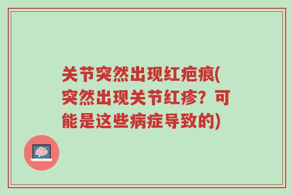 关节突然出现红疤痕(突然出现关节红疹?可能是这些病症导致的)-第1张图片-超越 关节突然出现红疤痕(突然出现关节红疹?可能是这些病症导致的)-第1张图片-超越