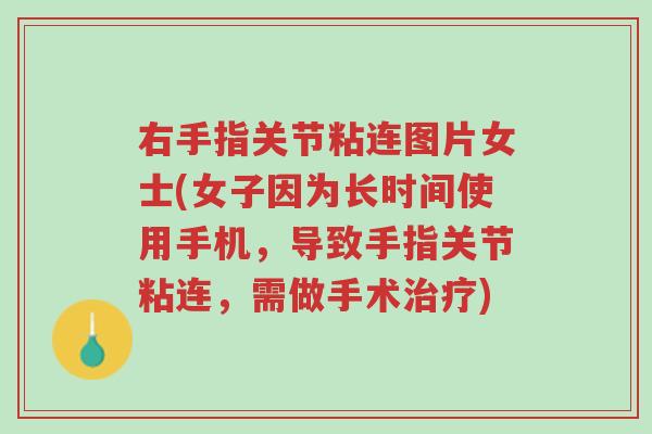 右手指关节粘连图片女士(女子因为长时间使用手机,导致手指关节粘连,需做手术治疗)-第1张图片-超越 右手指关节粘连图片女士(女子因为长时间使用手机,导致手指关节粘连,需做手术治疗)-第1张图片-超越