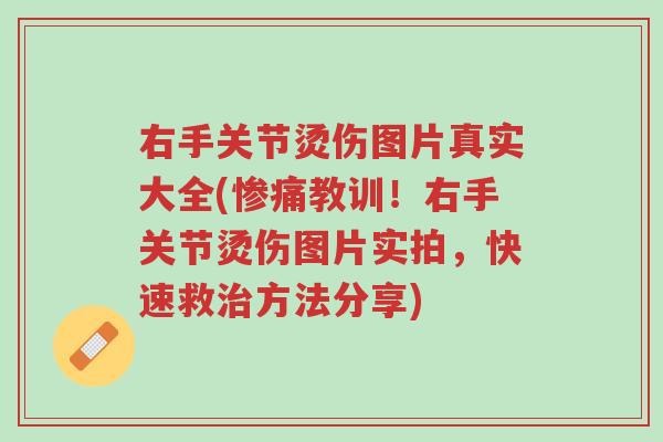 右手关节烫伤图片真实大全(惨痛教训!右手关节烫伤图片实拍,快速救治方法分享)-第1张图片-超越 右手关节烫伤图片真实大全(惨痛教训!右手关节烫伤图片实拍,快速救治方法分享)-第1张图片-超越