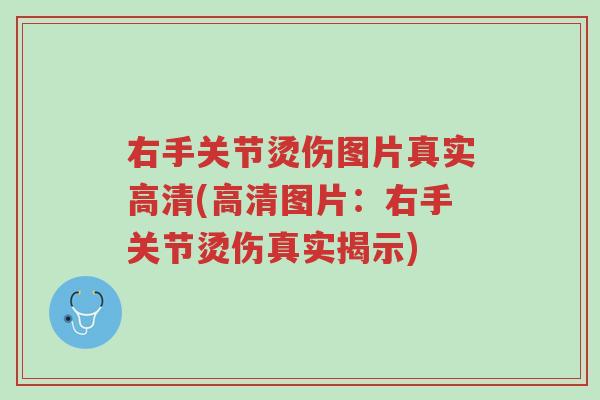 右手关节烫伤图片真实高清(高清图片：右手关节烫伤真实揭示)-第1张图片-超越