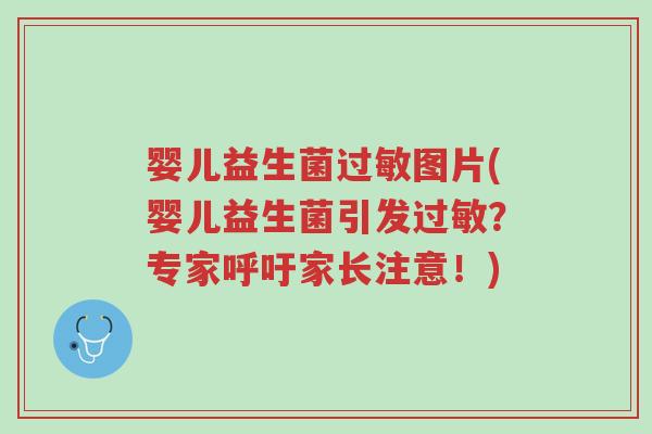 婴儿益生菌过敏图片(婴儿益生菌引发过敏？专家呼吁家长注意！)-第1张图片-超越