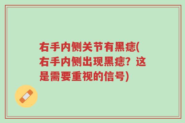 右手内侧关节有黑痣(右手内侧出现黑痣?这是需要重视的信号)-第1张图片-超越 右手内侧关节有黑痣(右手内侧出现黑痣?这是需要重视的信号)-第1张图片-超越