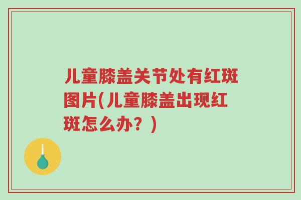 儿童膝盖关节处有红斑图片(儿童膝盖出现红斑怎么办?)-第1张图片-超越 儿童膝盖关节处有红斑图片(儿童膝盖出现红斑怎么办?)-第1张图片-超越