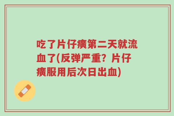吃了片仔癀第二天就流血了(反弹严重?片仔癀服用后次日出血)-第1张图片-超越 吃了片仔癀第二天就流血了(反弹严重?片仔癀服用后次日出血)-第1张图片-超越