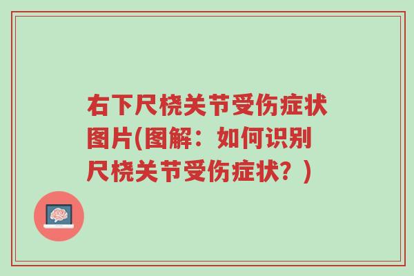 右下尺桡关节受伤症状图片(图解:如何识别尺桡关节受伤症状?)-第1张图片-超越 右下尺桡关节受伤症状图片(图解:如何识别尺桡关节受伤症状?)-第1张图片-超越